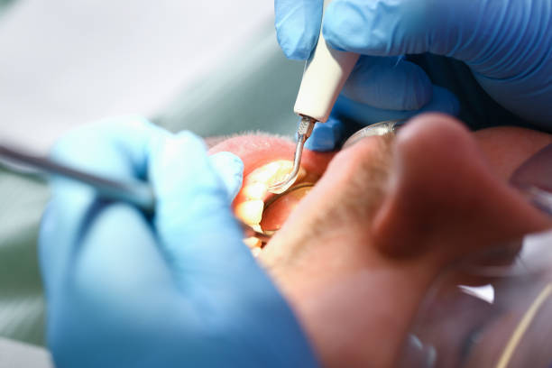 Best Broken or Cracked Tooth Emergency Dentist in Ransomville, NY