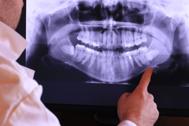 Best Emergency Dental Extractions in Ransomville, NY